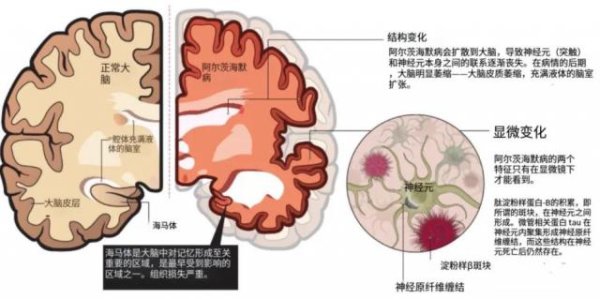 配资公司是怎么运作的 新研究！一种可以预防痴呆的饮食模式，这7类食物是核心
